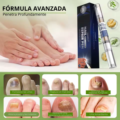 MyCurePro® Lápiz Antifúngico con Fórmula Avanzada – Contra Pie de Atleta y Hongos en Uñas