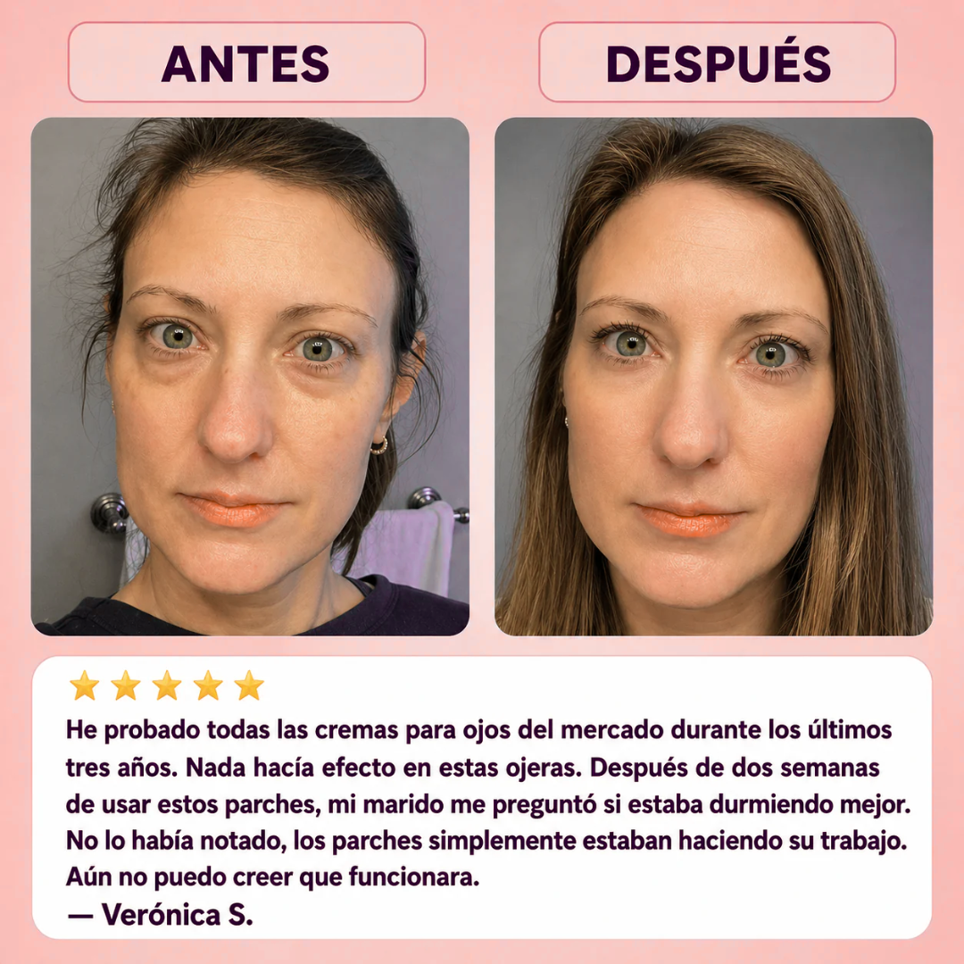 CureDerm — Microagujas que penetran y transforman en 7 días(1 CajaX4 Unidades)