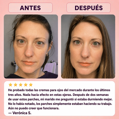 CureDerm — Microagujas que penetran y transforman en 7 días(1 CajaX4 Unidades)