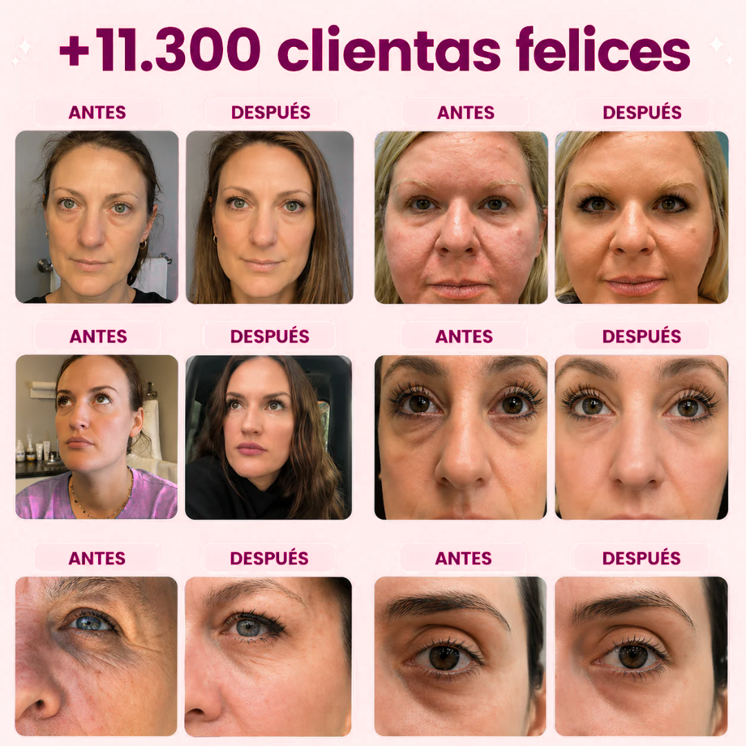 CureDerm — Microagujas que penetran y transforman en 7 días(1 CajaX4 Unidades)