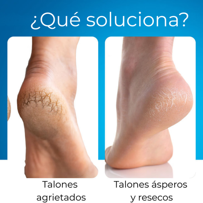 CurDerm Urea Stick · Adiós talones resecos desde hoy