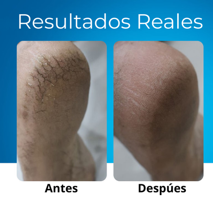 CurDerm Urea Stick · Adiós talones resecos desde hoy