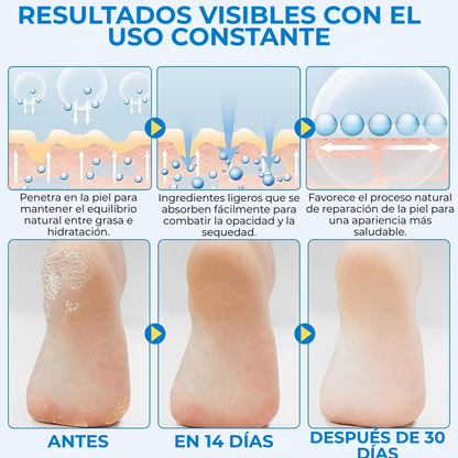 CurDerm Urea Stick · Adiós talones resecos desde hoy