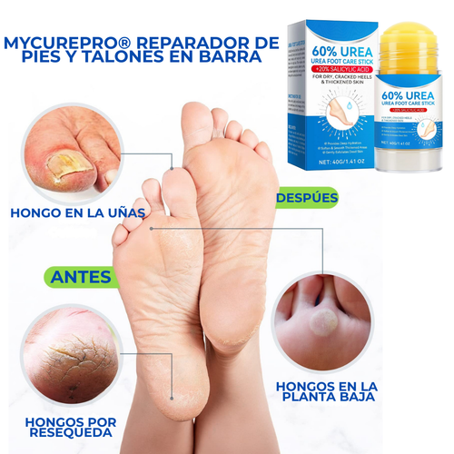 CurDerm Urea Stick · Adiós talones resecos desde hoy